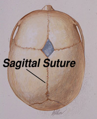 Sagittal Suture Diagram